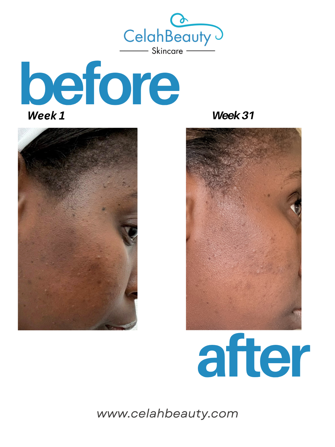 Even+ Brightening Serum